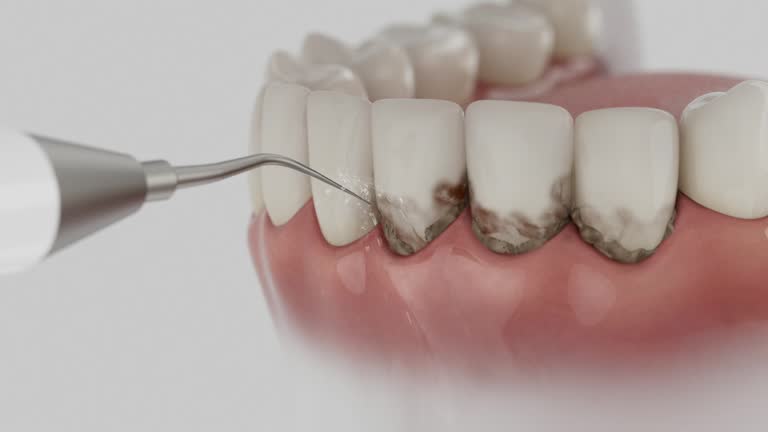 Trusted Teeth Cleaning And Checkup service in Catlettsburg, KY - Dentist Open Now